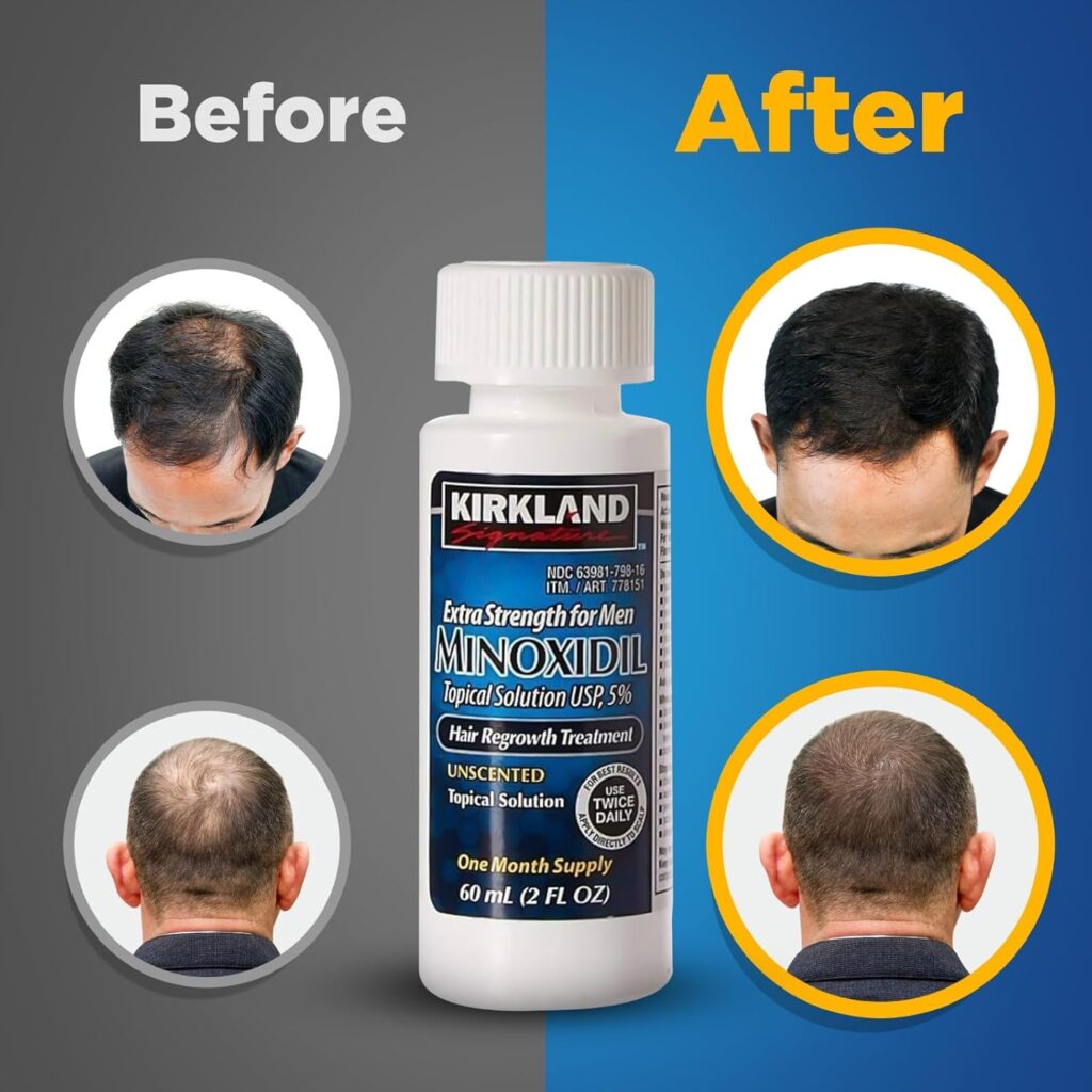Minoxidil