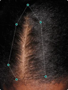 Womens Hair Growth Supplements